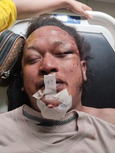 Jasad Penuh Luka, Keluarga Minta Polisi Usut Penyebab Kematian Nico Saragih